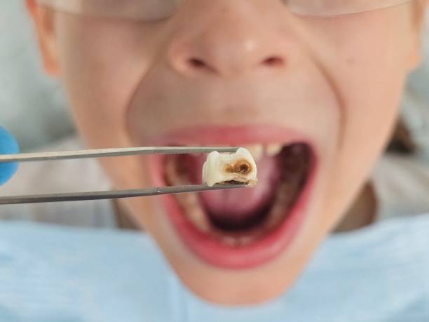 Best Emergency Dental Surgery in Auburn, NE